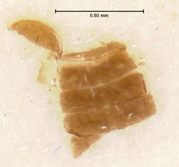 Media type: image;   Entomology 6787 Aspect: abdomen ventral view